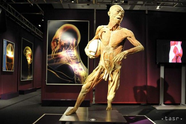 KDH: Human Body Exhibition Should Be Banned, It's Unethical and Illegal