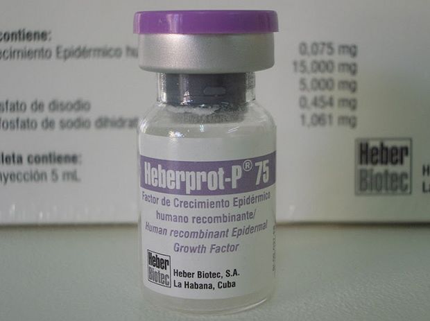 Fico: Treatment of Diabetic Foot with Cuban Drug Brings First Results
